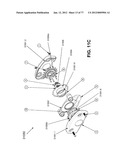 CAST REMOVAL SYSTEM diagram and image