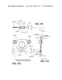 CAST REMOVAL SYSTEM diagram and image