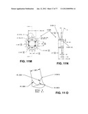 CAST REMOVAL SYSTEM diagram and image