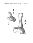 CAST REMOVAL SYSTEM diagram and image