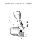 CAST REMOVAL SYSTEM diagram and image