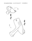 CAST REMOVAL SYSTEM diagram and image