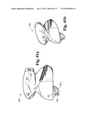 CAST REMOVAL SYSTEM diagram and image