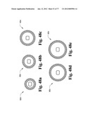 CAST REMOVAL SYSTEM diagram and image