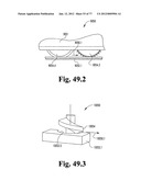 CAST REMOVAL SYSTEM diagram and image