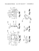 CAST REMOVAL SYSTEM diagram and image