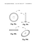 CAST REMOVAL SYSTEM diagram and image