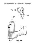 CAST REMOVAL SYSTEM diagram and image