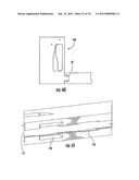 Patient single surface system diagram and image