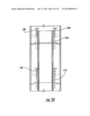 Patient single surface system diagram and image