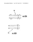 Patient single surface system diagram and image