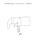 Patient single surface system diagram and image