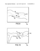 METHOD FOR DISPLAY OF IMAGES UTILIZING CURVED PLANAR REFORMATION     TECHNIQUES diagram and image