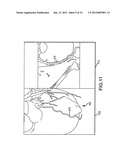 METHOD FOR DISPLAY OF IMAGES UTILIZING CURVED PLANAR REFORMATION     TECHNIQUES diagram and image