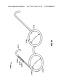 Electro-Active Opthalmic Lens Having An Optical Power Blending Region diagram and image