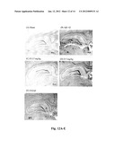 METHOD FOR PREVENTING OR TREATING AMYLOID BETA PEPTIDE-ASSOCIATED DISEASES     OR CONDITIONS, AND METHOD FOR INHIBITING FORMATION, ACCUMULATION OR     AGGREGATION OF AMYLOID BETA PEPTIDES diagram and image