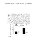 NITRIC OXIDE DONORS FOR TREATMENT OF DISEASE AND INJURY diagram and image