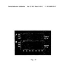 NITRIC OXIDE DONORS FOR TREATMENT OF DISEASE AND INJURY diagram and image