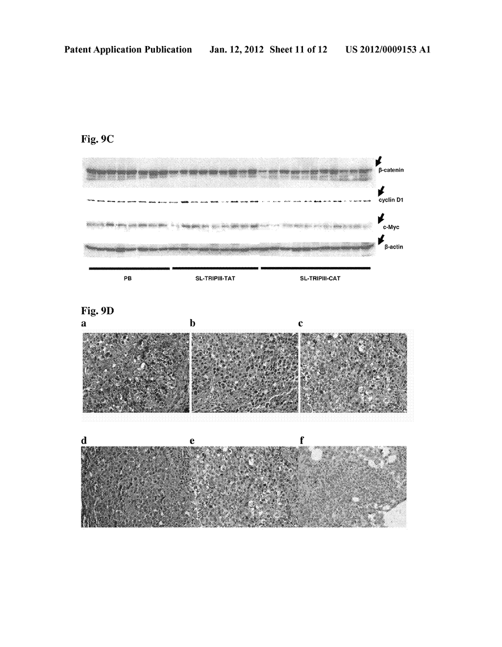 COMPOSITIONS FOR BACTERIAL MEDIATED GENE SILENCING AND METHODS OF USING     THE SAME - diagram, schematic, and image 12
