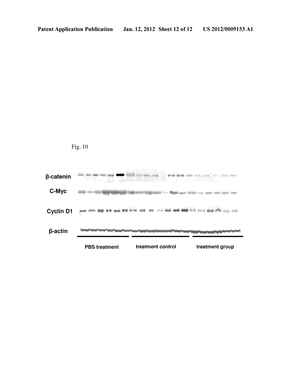 COMPOSITIONS FOR BACTERIAL MEDIATED GENE SILENCING AND METHODS OF USING     THE SAME - diagram, schematic, and image 13