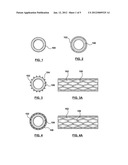 Method of Making a Stent with Hollow Struts diagram and image