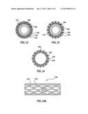 Method of Making a Stent with Hollow Struts diagram and image