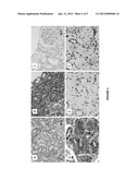 PEPTIDE BIOMARKERS PREDICTIVE OF RENAL FUNCTION DECLINE AND KIDNEY DISEASE diagram and image