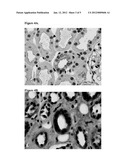 PEPTIDE BIOMARKERS PREDICTIVE OF RENAL FUNCTION DECLINE AND KIDNEY DISEASE diagram and image