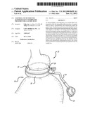 ASSEMBLY AND METHOD FOR AUTOMATICALLY CONTROLLING PRESSURE FOR A GASTRIC     BAND diagram and image