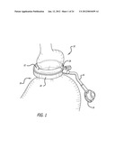 ASSEMBLY AND METHOD FOR AUTOMATICALLY CONTROLLING PRESSURE FOR A GASTRIC     BAND diagram and image