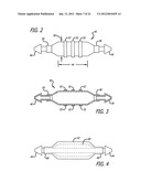 ASSEMBLY AND METHOD FOR AUTOMATICALLY CONTROLLING PRESSURE FOR A GASTRIC     BAND diagram and image