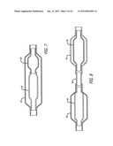 ASSEMBLY AND METHOD FOR AUTOMATICALLY CONTROLLING PRESSURE FOR A GASTRIC     BAND diagram and image