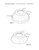 ASSEMBLY AND METHOD FOR AUTOMATICALLY CONTROLLING PRESSURE FOR A GASTRIC     BAND diagram and image