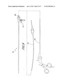 ACCESS SYSTEM WITH REMOVABLE OUTFLOW CHANNEL diagram and image