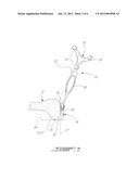 CAS SYSTEM FOR CONDYLE MEASUREMENT diagram and image