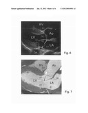 IMAGING APPARATUS AND METHOD FOR MONITORING A BODY UNDER EXAMINATION diagram and image