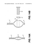 OPACITY TECHNOLOGY diagram and image