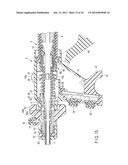 SURGICAL APPARATUS diagram and image