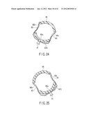 SURGICAL APPARATUS diagram and image