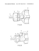 SURGICAL APPARATUS diagram and image