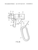 SURGICAL APPARATUS diagram and image