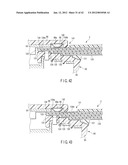 SURGICAL APPARATUS diagram and image