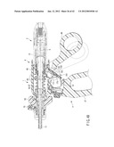 SURGICAL APPARATUS diagram and image