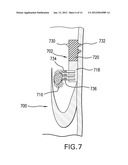 LOCAL DELIVERY OF THERAPEUTIC AGENT TO HEART VALVES diagram and image