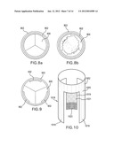 LOCAL DELIVERY OF THERAPEUTIC AGENT TO HEART VALVES diagram and image