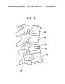 ORTHOPEDIC CEMENT AND USE OF SAME IN RADIATION THERAPY diagram and image