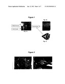 MULTI-LAYERED SURGICAL PROSTHESIS diagram and image