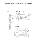 SPINAL STABILIZATION SYSTEM UTILIZING SCREW AND EXTERNAL FACET AND/OR     LAMINA FIXATION diagram and image