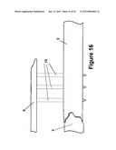 Method and apparatus for minimally invasive subcutaneous treatment of     humerus fractures diagram and image