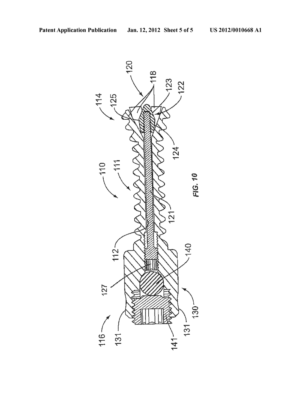 EXPANDABLE SURGICAL IMPLANT - diagram, schematic, and image 06